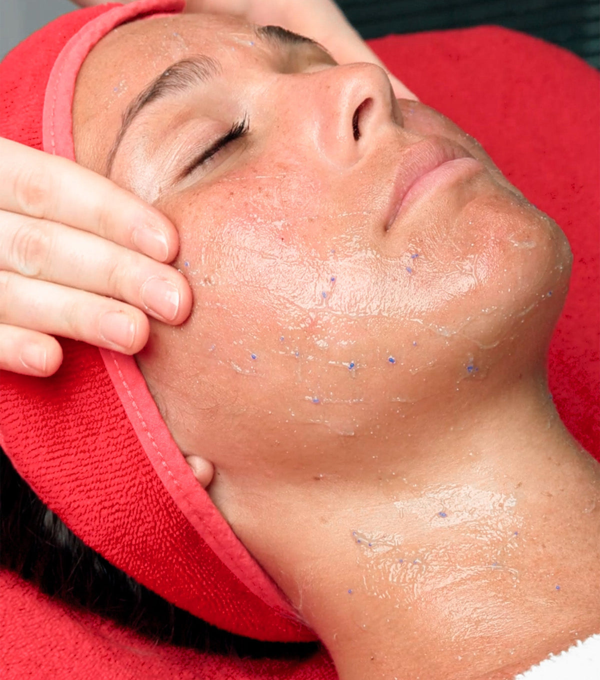 Hydra Summum care