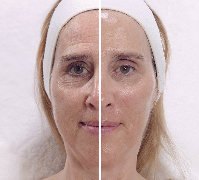 Visible Age Reverse Treatment